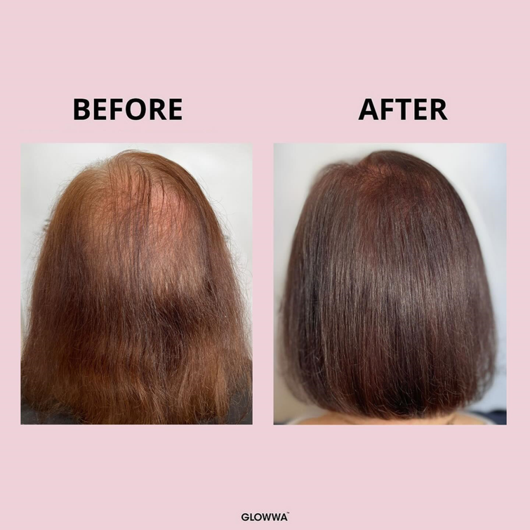 Glowwa Hair Food - 60 capsules - Afbeelding 7